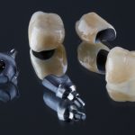 types of dental crown