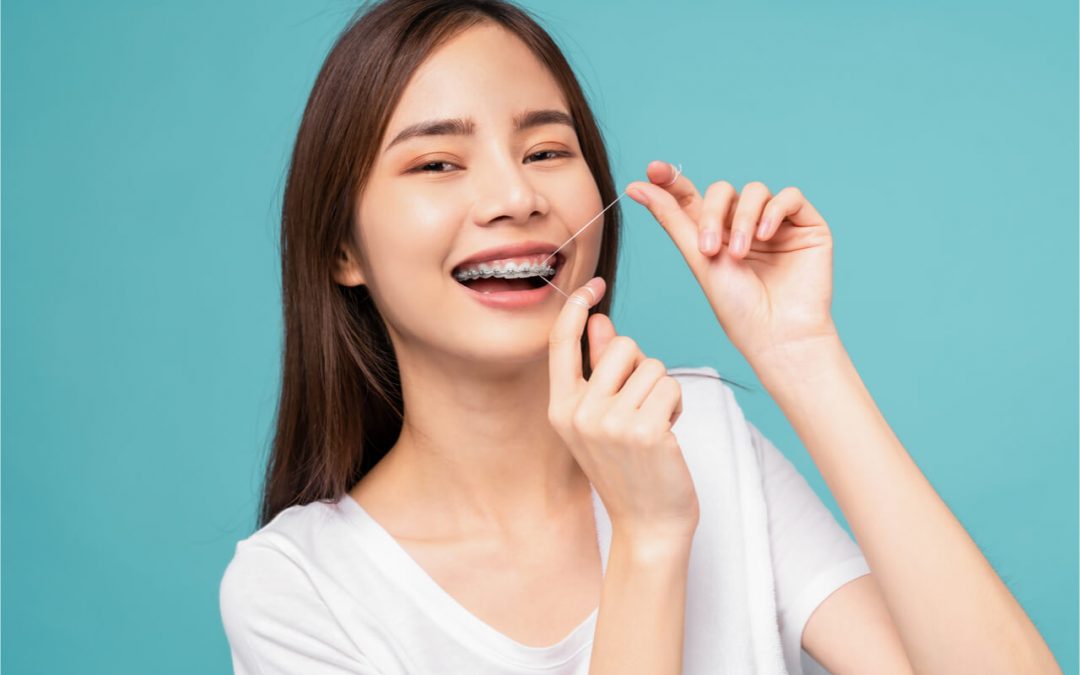 How to Use Dental Floss for Braces: A Guide for Orthodontic Patients
